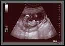 ultrasound2