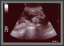 ultrasound3